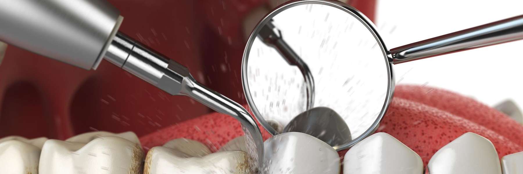 dentist cleans patient's teeth with dental tool, showcasing family-friendly dental care for all ages