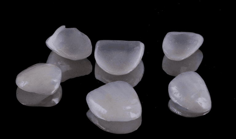 Bright white teeth arranged on a dark surface, highlighting choices for dental veneers